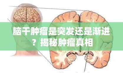 脑干肿瘤是突发还是渐进？揭秘肿瘤真相